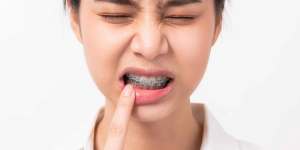 ortodontik ağrı