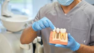 diş implant taktıranlar