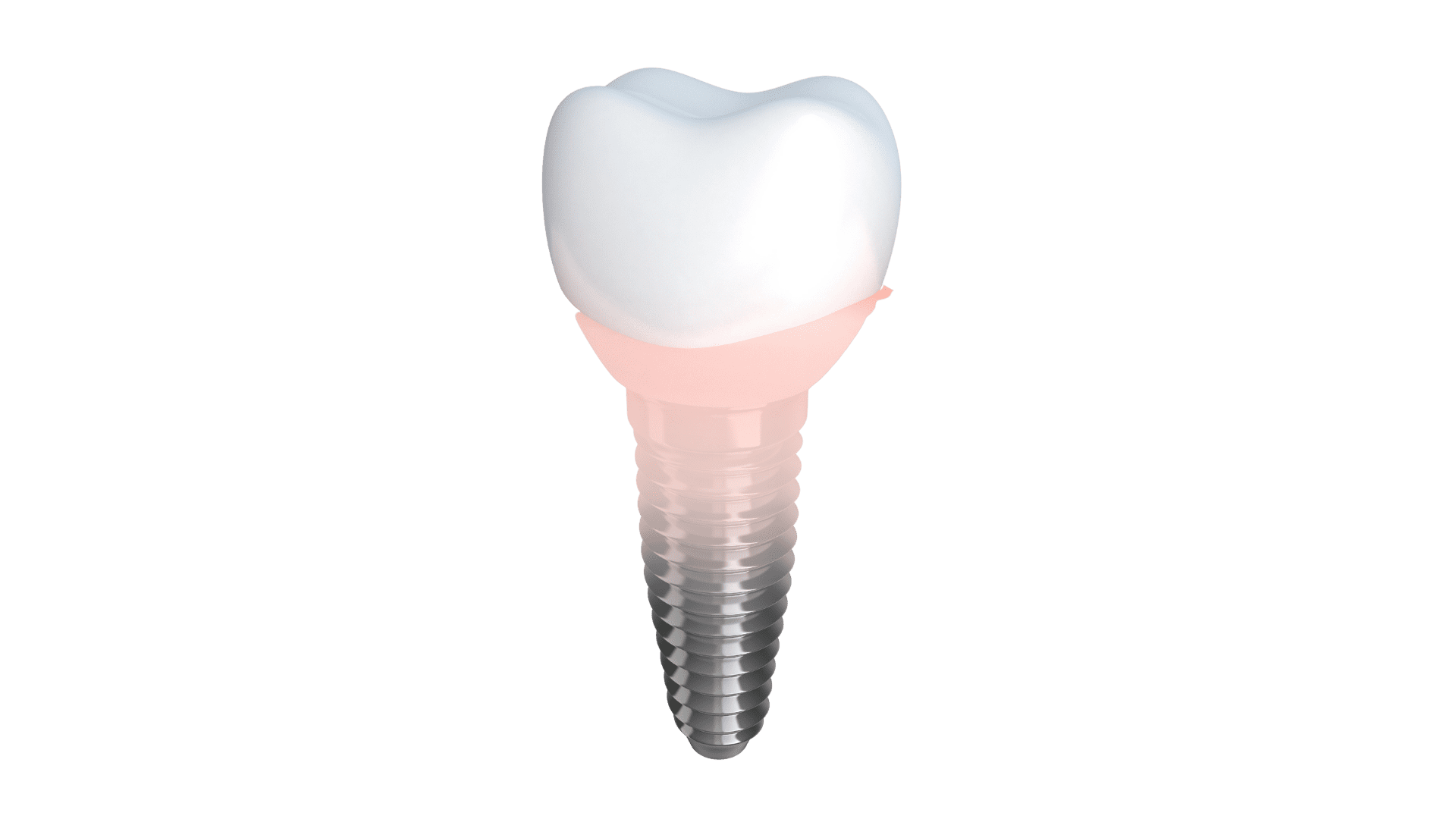 implant diş
