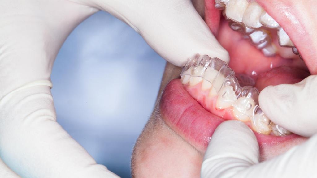 nevşehir şeffaf plak ortodonti