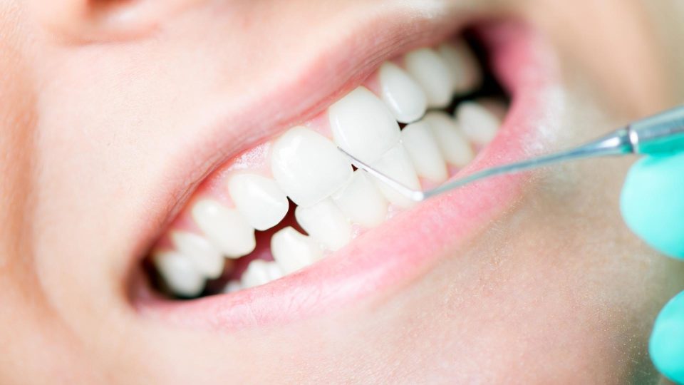 diş taşı temizliği zararlı mıdır